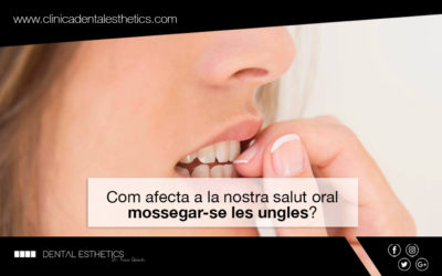 Com afecta a la nostra salut oral mossegar-se les ungles?