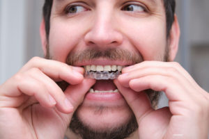 ortodòncia i implants dentals