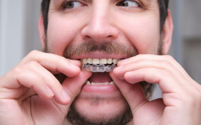 Ortodòncia i implants dentals: són tractaments compatibles?
